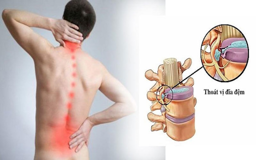 Causes of low back pain in middle-aged women